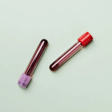 Foto di Karolina Grabowska da Pexels: https://www.pexels.com/it-it/foto/rosso-colore-sangue-tubi-4047146/