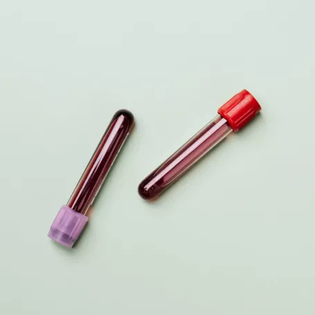 Foto di Karolina Grabowska da Pexels: https://www.pexels.com/it-it/foto/rosso-colore-sangue-tubi-4047146/